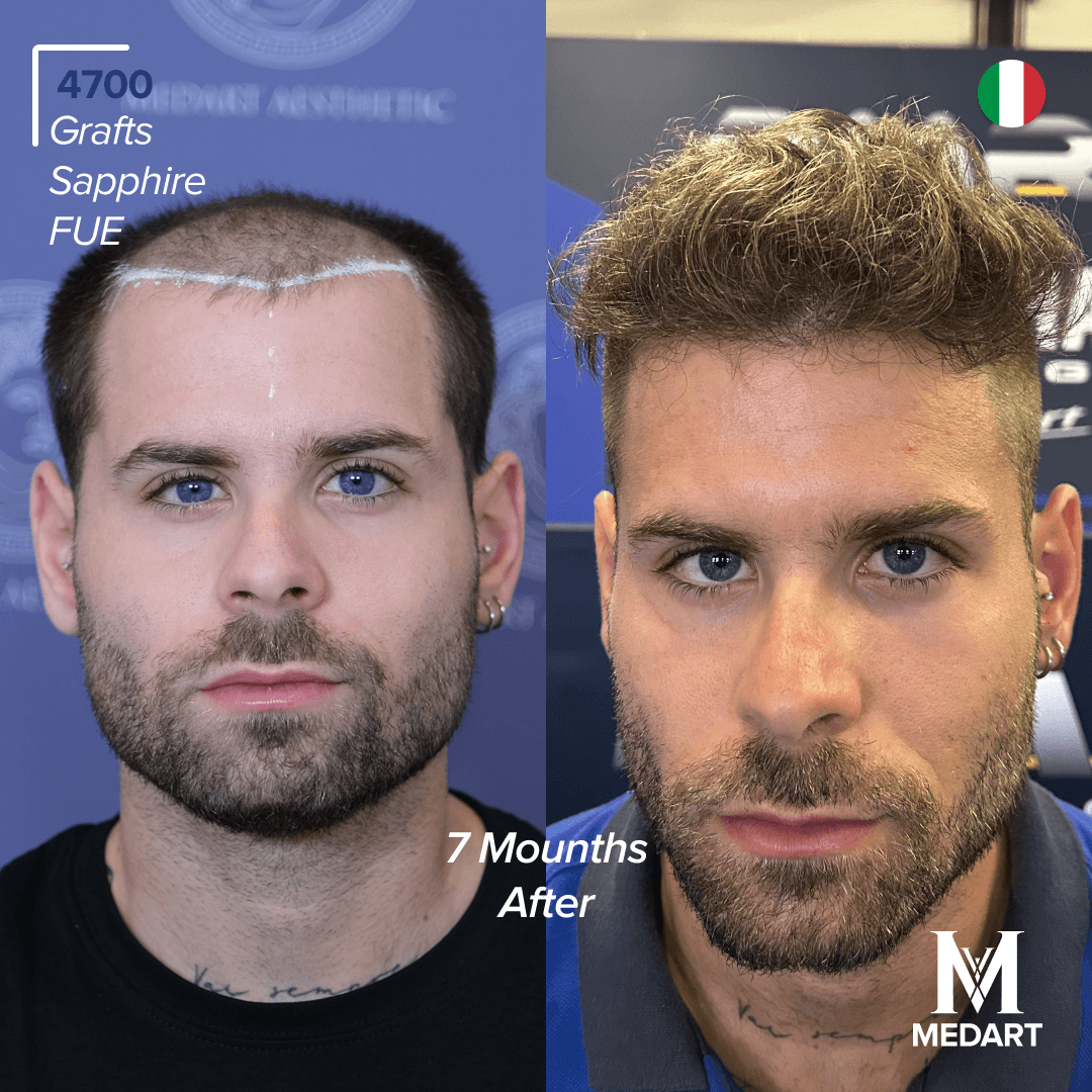 Before After transformation 1