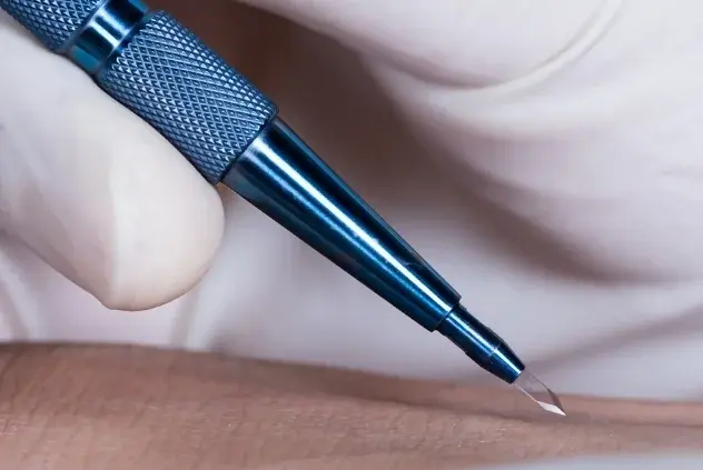 Sapphire Hair Transplant